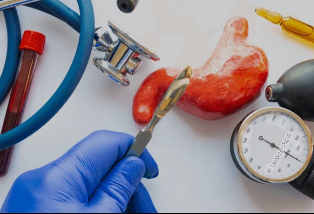 Acompanhamento Pós-Bariátrica